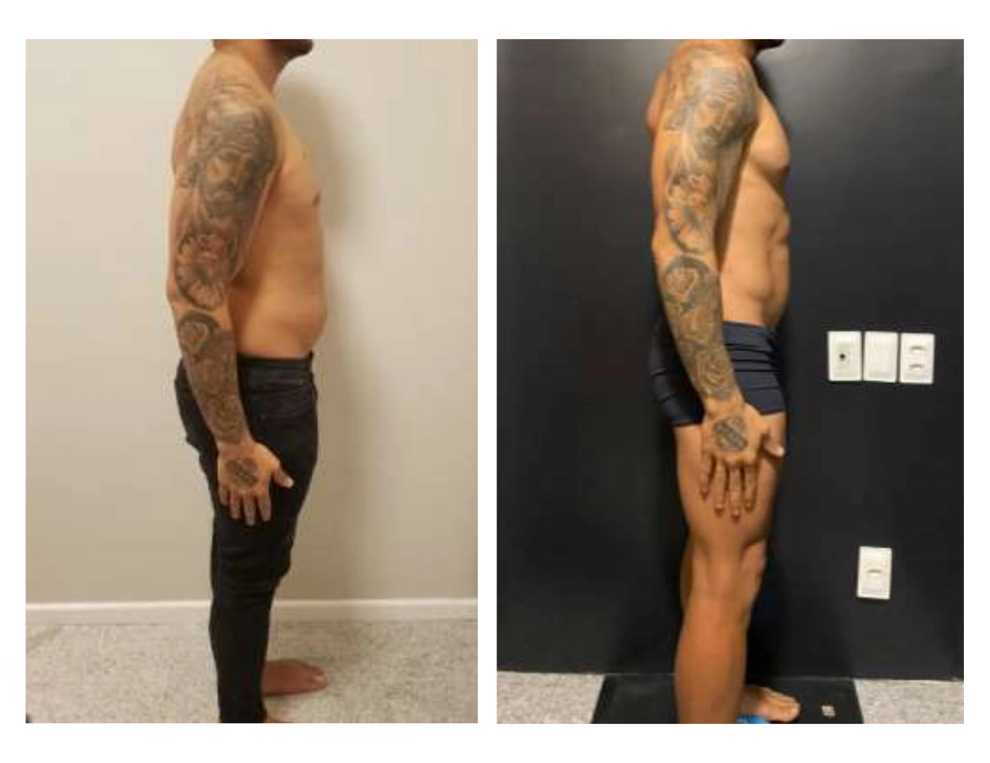 antes-e-depois-2-dr-diego-pascaretta-medico-nutrologo-especialista-em-saude-metaabolica-reposicao-hormonal-e-protocolos-personaizados-de-alta-performance- (1)